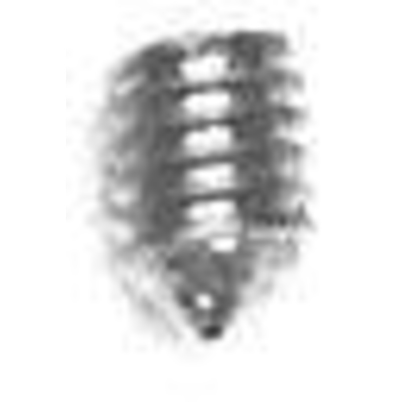 4mm Nickel,1.5m Allen Wrench Set Screw, Steel-PK10, #P-1493-4MM-NIC