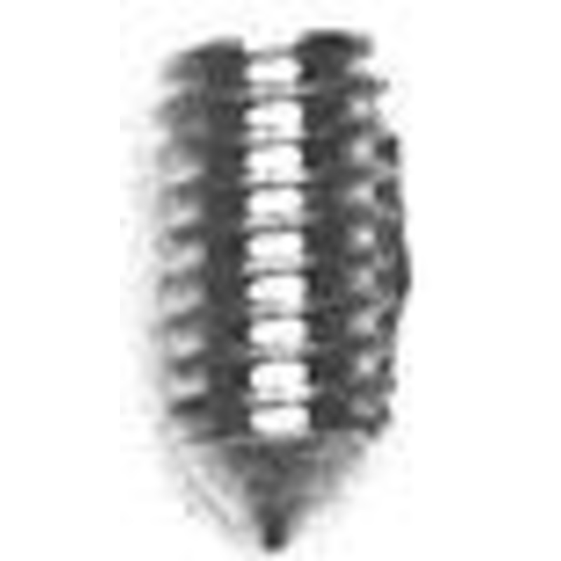 6mm Nickel, 1.5M Allen Wrench Set Screw, Steel-PK10, #P-1493-6MM-NIC